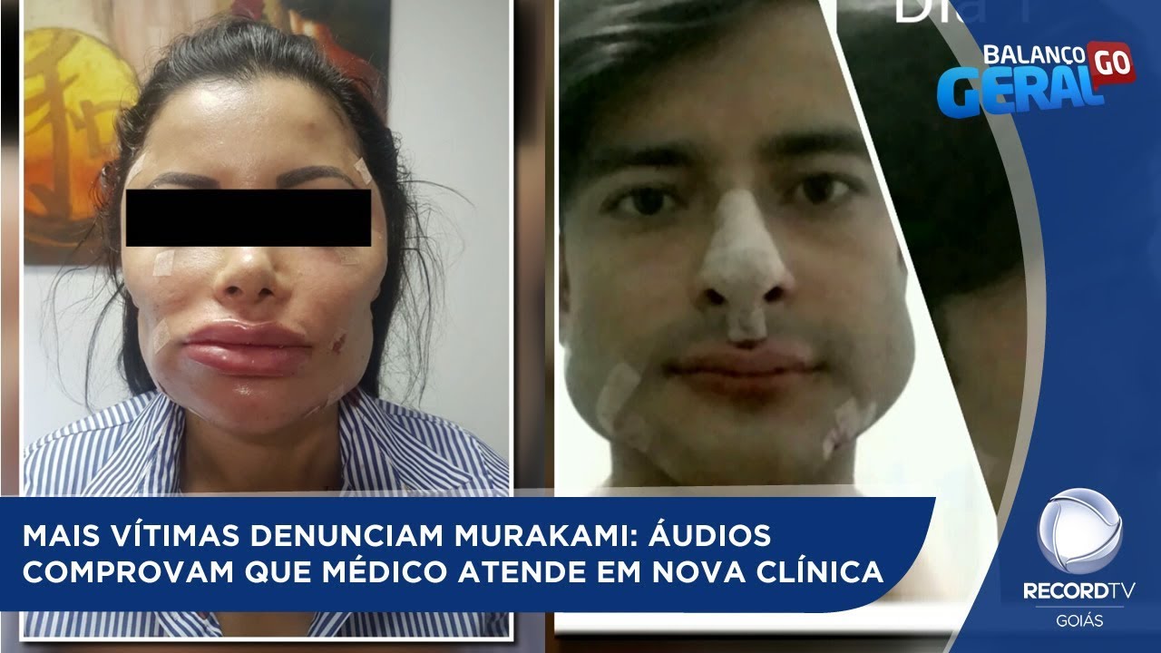 Wesley Murakami - un cirujano deformó rostro de pacientes