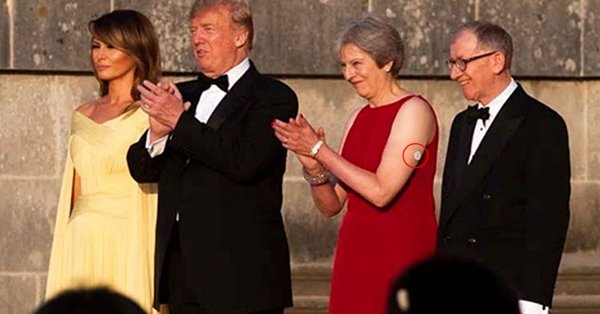 Theresa May tiene un dispositivo blanco en su brazo