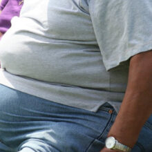 Cerca del 40% de la población venezolana sufre de obesidad