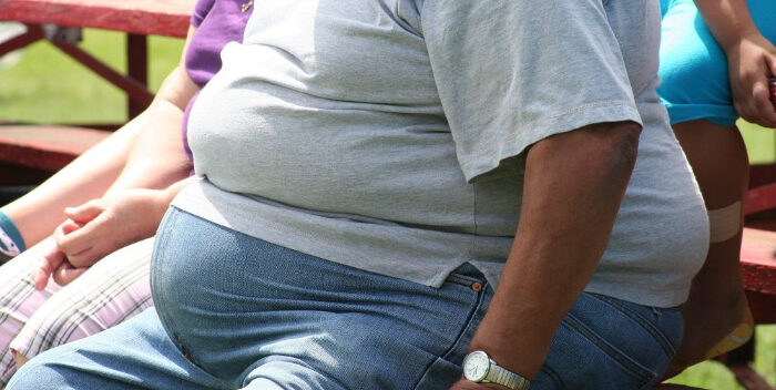 Cerca del 40% de la población venezolana sufre de obesidad